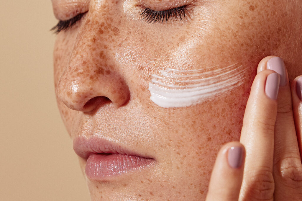 Close-up of female face with freckled skin. High-detailed shot of woman skin applying moisturizer