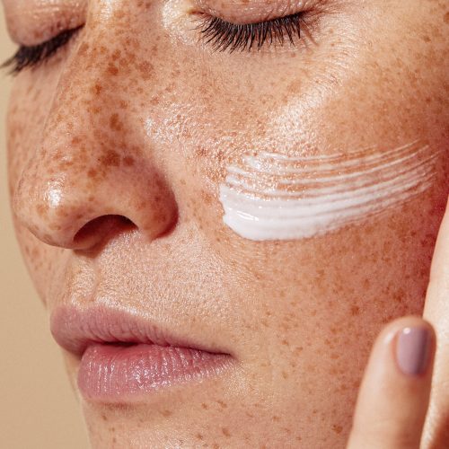 Close-up of female face with freckled skin. High-detailed shot of woman skin applying moisturizer